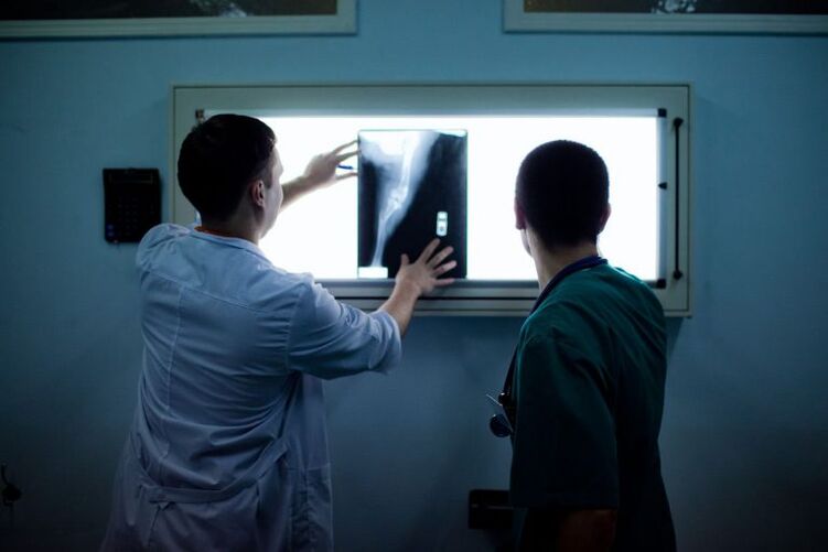 Ташхиси артроз дар x -ray